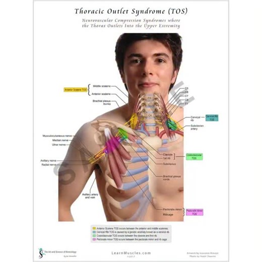 The scalene muscles are involved in respiration, neck flexion, neck side bending, and neck rotation. They also elevate the first two ribs and can contribute to Thoracic Outlet Syndrome. They also are part of the cervical plexus and affect the lumbar plexus affected by the psoas. Thus the scalenes and psoas are part of the Sympathetic chain, the opposite of the vagus nerve. Dysfunction of the scalenes can result in faulty breathing, neck pain, TOS, and overexcitement of the nervous system. This b