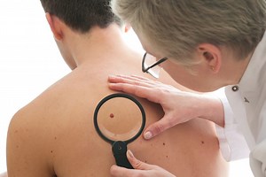 Annual Skin Examinations