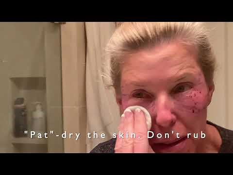 Caring for your Skin after Laser Resurfacing