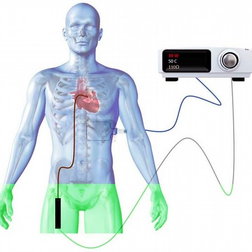 Do YOU know how what happens during cardiac ablation?