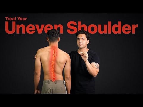 How to Fix Uneven Shoulders | Causes, Pain & Exercises
