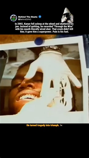 How Kanye West Recorded a Hit With a Wired Jaw 🎤#KanyeWest #ThroughTheWire #Ye #HipHopHistory #rap