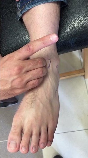 dorsalis pedis artery palpation