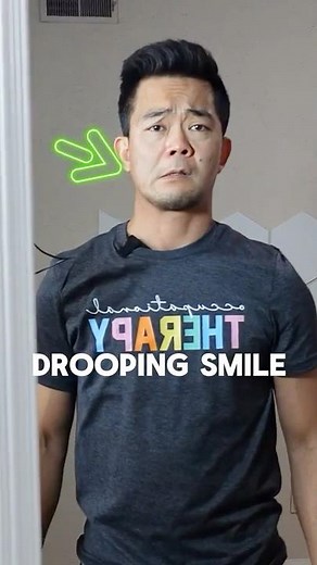 Stroke or Bell’s Palsy Face Exercise | Wake Up Your Smile & Fix Facial Asymmetry #stroke #bellspalsy