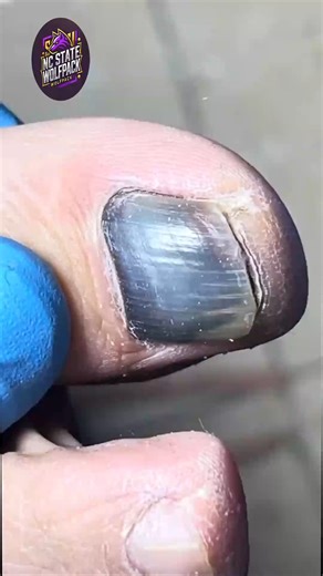 Professional dry cuticle care using mindful calm home routines 🍒💐 #CalmCareTips #EverydayComfort #WellnessAtHome | NC State Wolfpack on TheWolfpacker.com