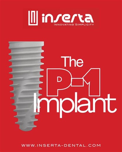 Simon @ Inserta Dental on Instagram: "The P-1 Implant. Designed for Predictability. Built for the Long Term. When it comes to modern implant dentistry, success isn’t just about placement, it’s about biology, prosthetics, and long-term stability working together. The Inserta P-1 Implant has been engineered with this exact philosophy in mind. ✔️ One universal conical connection across all diameters and lengths ✔️ Excellent primary stability for immediate and delayed protocols ✔️ Predictable soft t