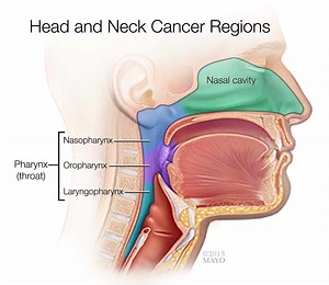 Rise in Head and Neck Cancer Spurs Innovations in Care - Mayo Clinic News Network