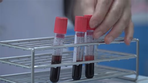 Sorry, we don’t accept British blood - when America got paranoid