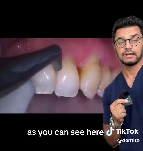 Dentite on TikTok