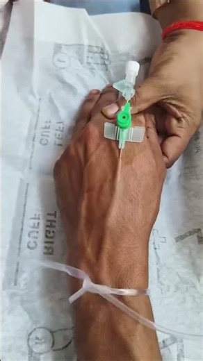 Nurse Cannulation Techniques Explained #cannulation