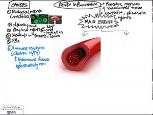 Acute inflammation: Overview/Approach
