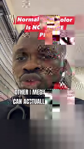 The normal urine color is not white pls! | Dr. Oxford1