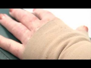 Keeping Lymphedema Under Wraps