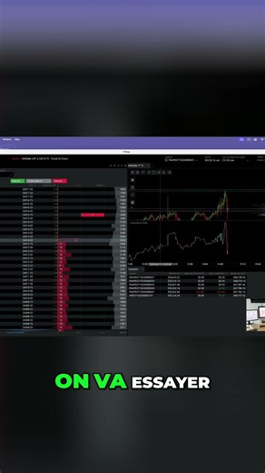 #10 Trader wins big position and perfect exit on the stock market!