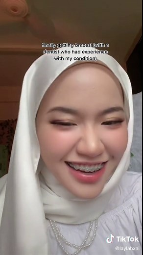 Understanding Enamel Hypoplasia: Causes and Treatment