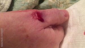 Cut on hand bleeds into pool of blood before eventually dripping downwards at end of clip.