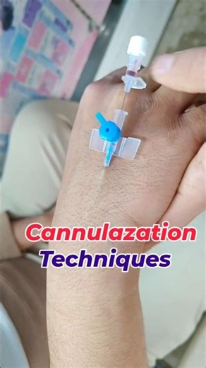 IV Cannulation Procedure Step by Step | Cannulazation Technique for Nurses. #nurse #cannula #viral