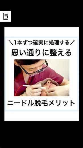 One hair at a time, precisely treated: What are the advantages of needle epilation? #shorts