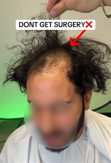Hands on class - This Sunday Feb 8th - Phoenix AZ📍 Last couple spots left👇 Comment “LEARN” to reserve your seat💬 #phoenix #class #hairloss #toupee #hairsystem