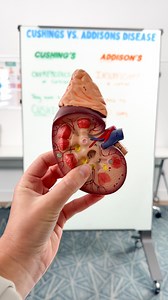 Kristine Tuttle on Instagram: "Addison's Disease vs. Cushing's Syndrome⁠ ⁠ Cushing’s 👉Overproduction of cortisol in the adrenal glands⁠ ⁠ Addison’s 👉Insufficient cortisol production in the adrenal glands⁠ ⁠ #cushingssyndrome #addisonsdisease #endocrine #medsurg #nurse #nursing #BSN #RN #LPN #nurseshelpingnurses⁠"