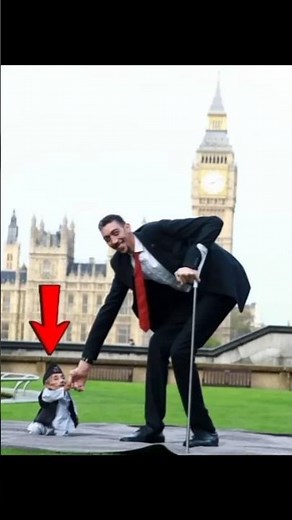 Smallest person in the world😨