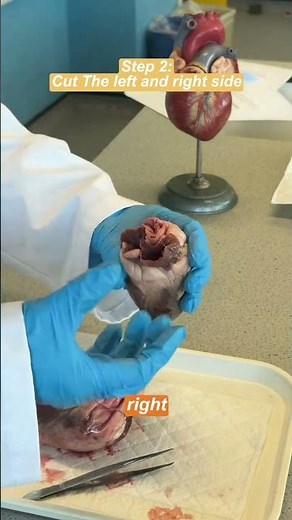 Watch this HEART get DISSECTED
