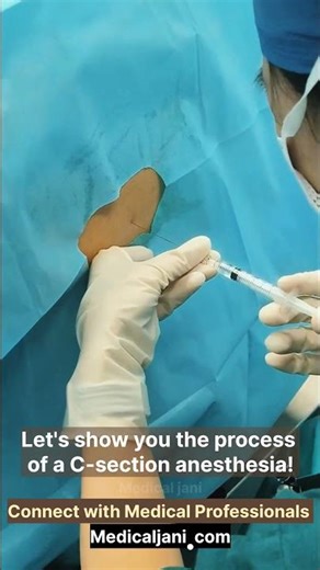 Let's show you the process of a C-section anesthesia #delivery #surgery #ytshorts #shorts #nurse