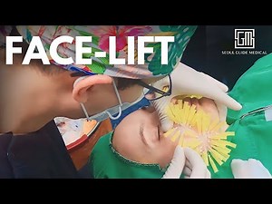 Non-Surgical Face lift in Korea | Ultra-Micro Thread Lift | Seoul Guide Medical