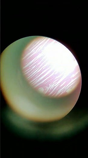 Cardiac Muscles (T.S) Under Microscope