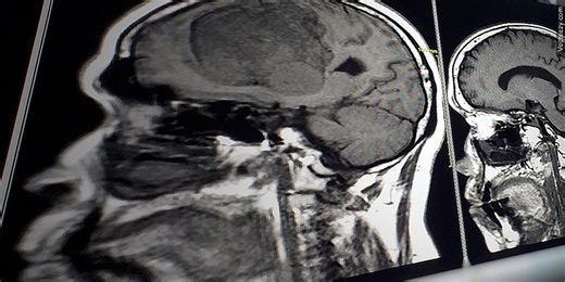 Understand the brain’s resilience during Mental Health Awareness Month