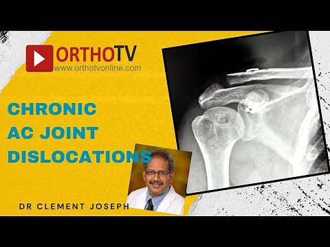 AC Joint Reconstruction by Dr Clement Joseph