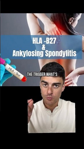 HLA-B27 gene = Disease ?