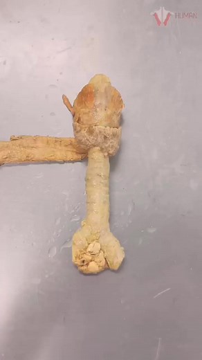 174K views · 3.1K reactions | REAL Human Trachea Why Your Airway Doesn’t Collapse#humen #body #fitness #fit #abs #healthy #gymlife #life #Doctor #reels #shorts | Human Anatomy | Facebook