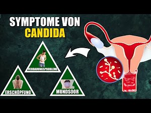 9 Symptome von Candida, auf die du achten solltest