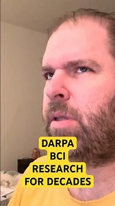 N3 BRAIN COMPUTER INTERFACE #bionic