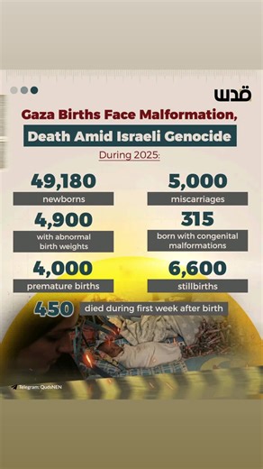 The Director of the Information Department at the Ministry of Health in Gaza, Zaher Al-Wahidi, said that the numbers of births with malformations, abnormal weights, and premature births during 2025 had been shocking in the strip. He added that the war had been the main cause of these unprecedented cases, which had not existed at this scale before the conflict, particularly in 2022. Women in Gaza had been exposed to dust and gunpowder from rockets, in addition to malnutrition and famine, which ha