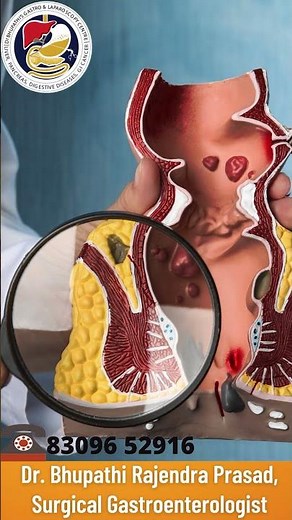 ఫిస్టులా అంటే ఏంటి..? || FISTULA : Causes & Symptoms || Dr. Bhupathi Rajendra Prasad