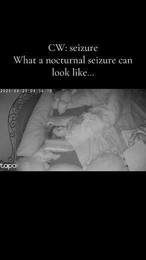 This is what a nocturnal seizure can look like. Nocturnal seizures are seizures that occur during sleep and can include abnormal movements (like this one), jerking or thrashing around, classic tonic clonic type seizure, vocalizations (screaming, shouting, or moaning), and behavioral/sensory issues like sudden awakening, confusion or disorientation upon awakening, unusual sensations like weird smells, tastes, or fear, and appearing in a dream-like state, staring off or having impaired awareness.