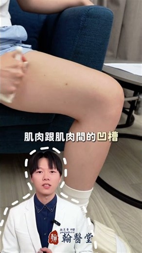 象腿人必看！醫師公開一招消腫神技輕鬆變回筷子腿✨ #shorts #消水腫 #刮痧 #thighfatloss #腿