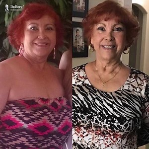 "Thank you, Dr. Berg! I started Feb 2 and I've lost 30 pounds and counting. I feel great!" - Frances Hamilton SHARE YOUR SUCCESS STORY BY CLICKING HERE: https://bit.ly/3iCeZAa | Dr. Eric Berg