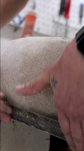 Lamination sockets in prosthetics. #customprosthetics #prosthetics #orthoticsandprosthetics