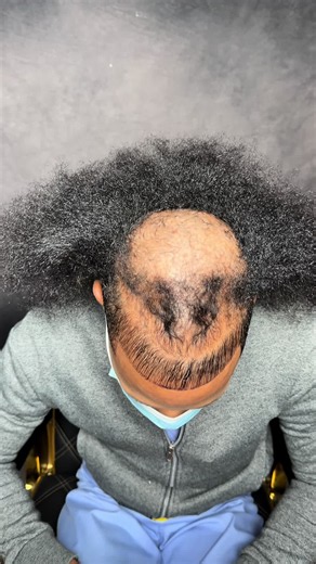 🚨 BOX TWISTS WITH EXTENSIONS ON THINNING & BALDING HAIR 🚨🔥 THIS ONE MEANS A LOT TO ME. ❤️ My client came in dealing with thinning and balding hair, and together we created a transformation that not only looks amazing but also serves a purpose. The goal wasn’t just to make the hair look fuller. The goal was to create a protective style that helps preserve the hair, reduce manipulation, and allow him to move through life with confidence while working toward healthier hair. CRISPY PARTS SEAMLESS