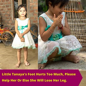 Tanaya is 4 yrs old now and is suffering "Local Gigantism", due to which her one leg is abnormal. She needs immediate medical treatment else, she may have to lose her leg. Please Help at: bit.ly/help-tanaya #milaap #help #donate #urgent #tumor | Milaap