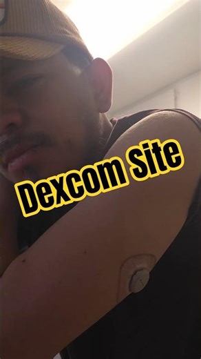 Dexcom sensor change