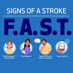 Learn to spot the signs of a stroke. Just remember F.A.S.T. | Henry Ford Health