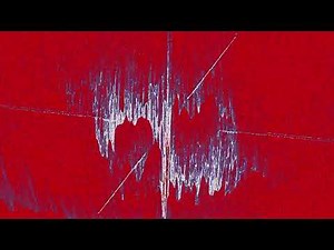 Charles-Olivier Paquette - Étude #5 Mouvement