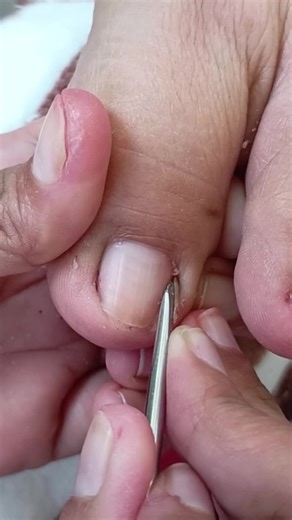 Ingrown Hair & Dry Skin Solutions