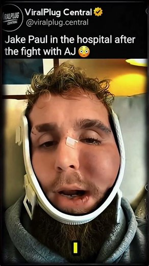 AFTERMATH 😳🏥 Jake Paul vs Anthony Joshua | SHOCKING Fallout & Reactions