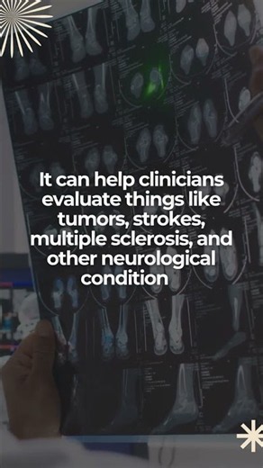 Medical Technology Explained: MRI