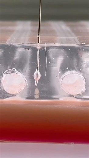 How Medicine Is Injected Into Muscle #goodtoknow #vet #medicine #technique #funfacts #educational